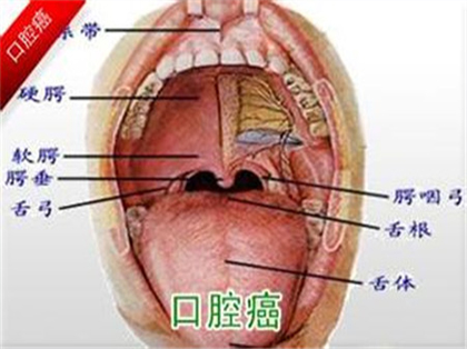 <b>口腔癌的早期症状</b>