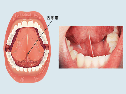 <b>什么是舌系带</b>