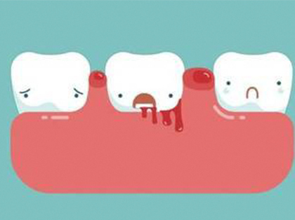 <b>牙龈出血能不能刷牙？</b>