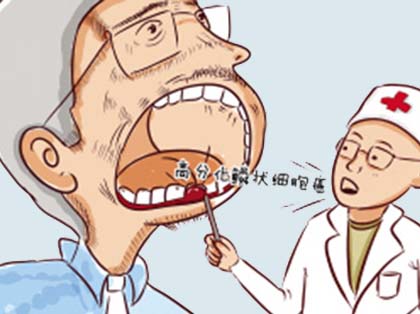<b>口腔癌的治疗方法</b>
