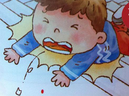 <b>如何避免儿童牙外伤？</b>