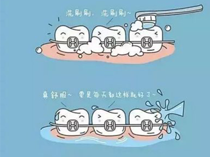 <b>儿童牙齿矫正的年龄？</b>