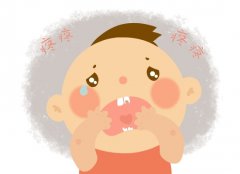 <b>发生龋齿是否因为缺钙？</b>