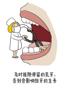 乳牙滞留需要拔牙吗？