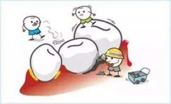 牙结石能刷掉吗