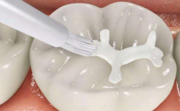 <b>儿童涂氟到底好不好？</b>